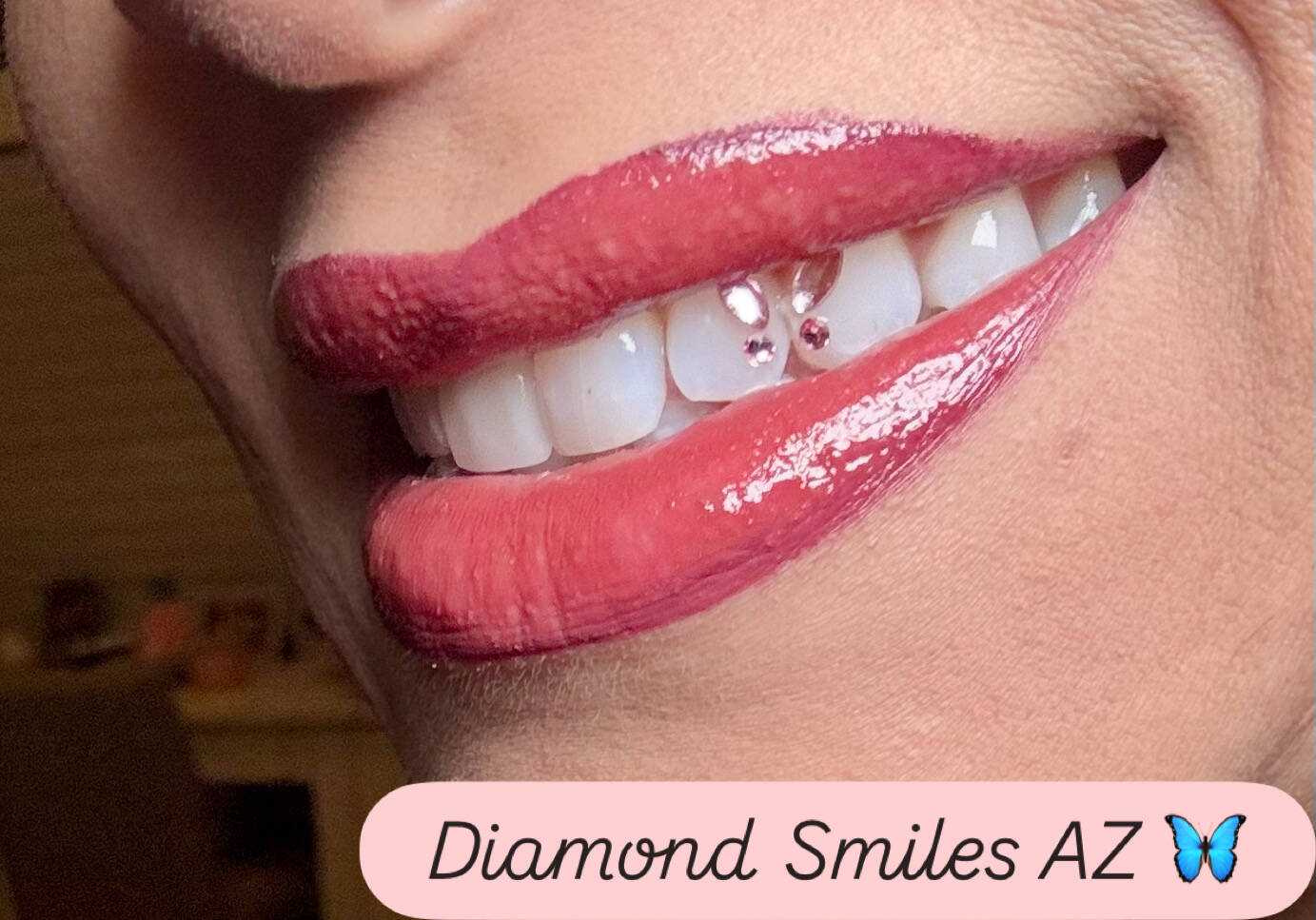 Professional Teeth Whitening & Tooth Gems in Ahwatukee Phoenix 
